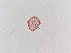 Protoperidinium
