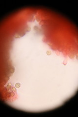 Zelleromyces australiensis