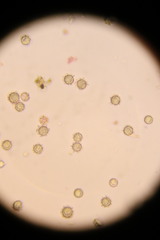 Zelleromyces australiensis