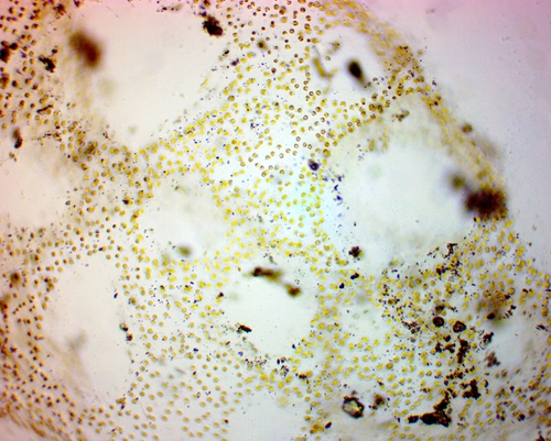 Actinotrichia observed 2022-03-17