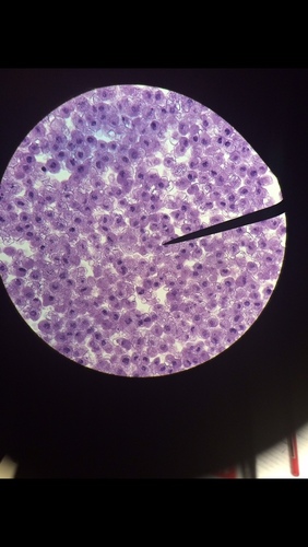 Plasmodium (penyebab malaria) (Plasmodium falciparum)