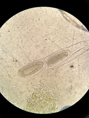 Pertusaria pustulata