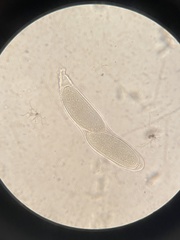 Pertusaria pustulata