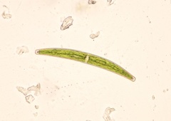 Closterium baillyanum