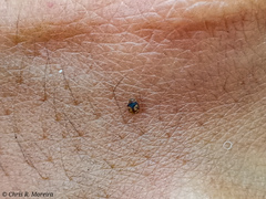 Scymnobius galapagoensis