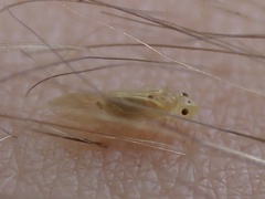 Valenzuela indicator