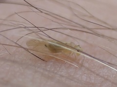 Valenzuela indicator