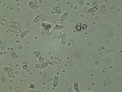 Dacrymyces minor