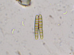 Opegrapha niveoatra