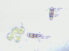 Hysterium angustatum