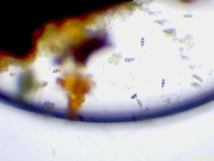 Hysterium angustatum