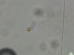 Botrydiopsis