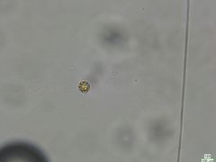 Botrydiopsis