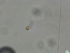Botrydiopsis