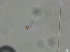 Botrydiopsis