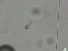 Botrydiopsis