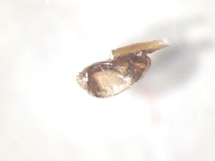Pediculus humanus capitis