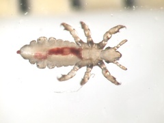 Pediculus humanus capitis