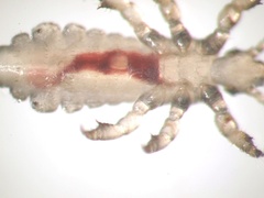 Pediculus humanus capitis