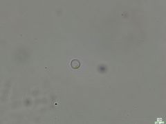 Coscinodiscophycidae