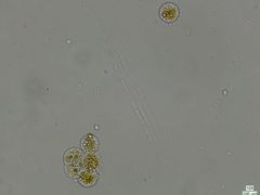 Chytridiomycota