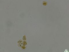 Chytridiomycota