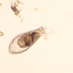 Hyalosphenia