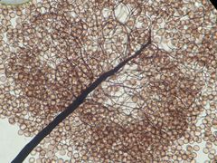 Paradiacheopsis rigida