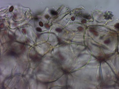 Coprinellus truncorum