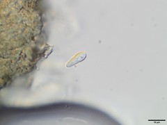 Sphaerellothecium cladoniae