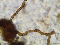 Sphaerellothecium cladoniae