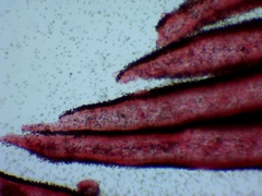 Coprinellus truncorum