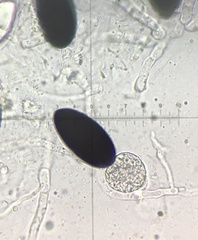 Podospora austrohemisphaerica