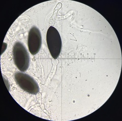 Podospora austrohemisphaerica