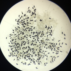 Podospora austrohemisphaerica