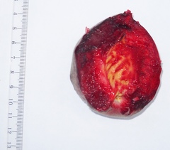 Prunus persica persica