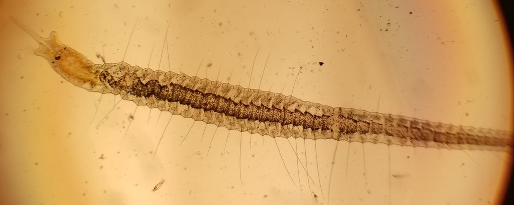 Stylaria lacustris from Carbondale, IL, USA on March 25, 2022 at 10:15 ...