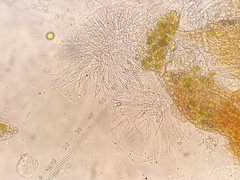 Epigloea soleiformis