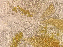 Epigloea soleiformis