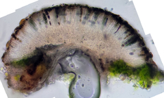 Rinodina pachysperma