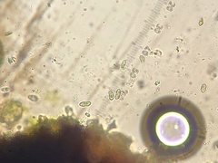 Stigmidium microspilum
