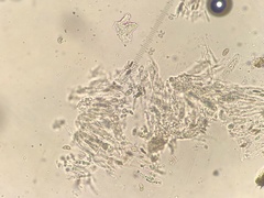 Stigmidium microspilum