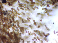 Gymnosporangium effusum