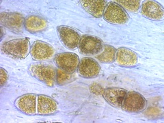 Gymnosporangium effusum