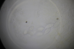 Paranectria oropensis