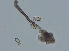 Cladosporium cladosporioides
