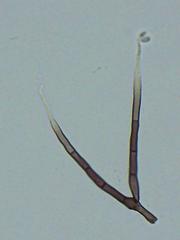 Pseudallescheria boydii
