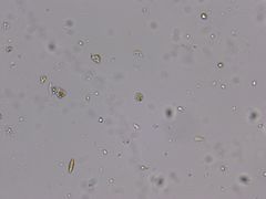 Chlorella