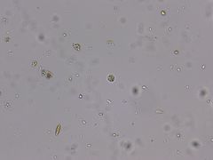 Chlorella
