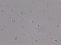 Chlorella